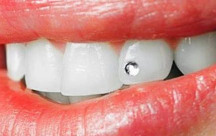 Tanddiamantje Mondhygiene Tiel