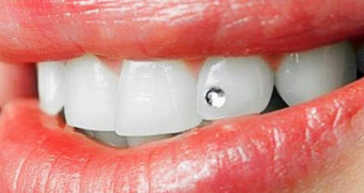 Tanddiamantje Mondhygiene Tiel
